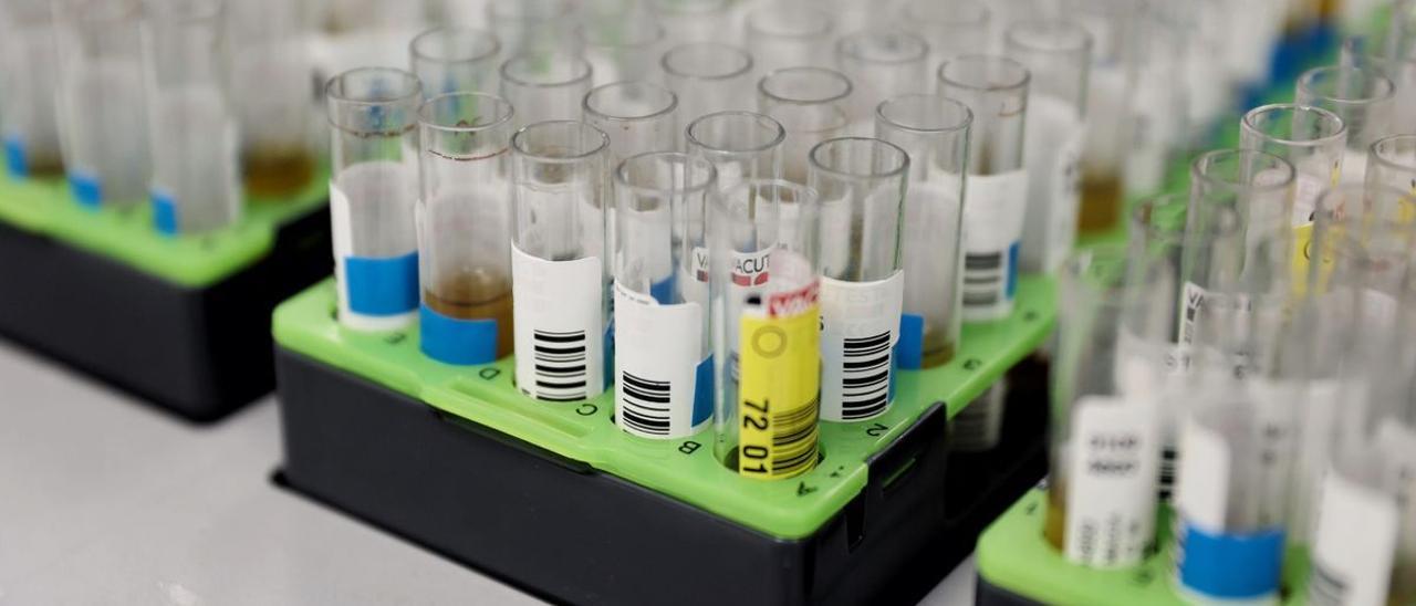 Probetas de pruebas PCR en un laboratorio de microbiología.