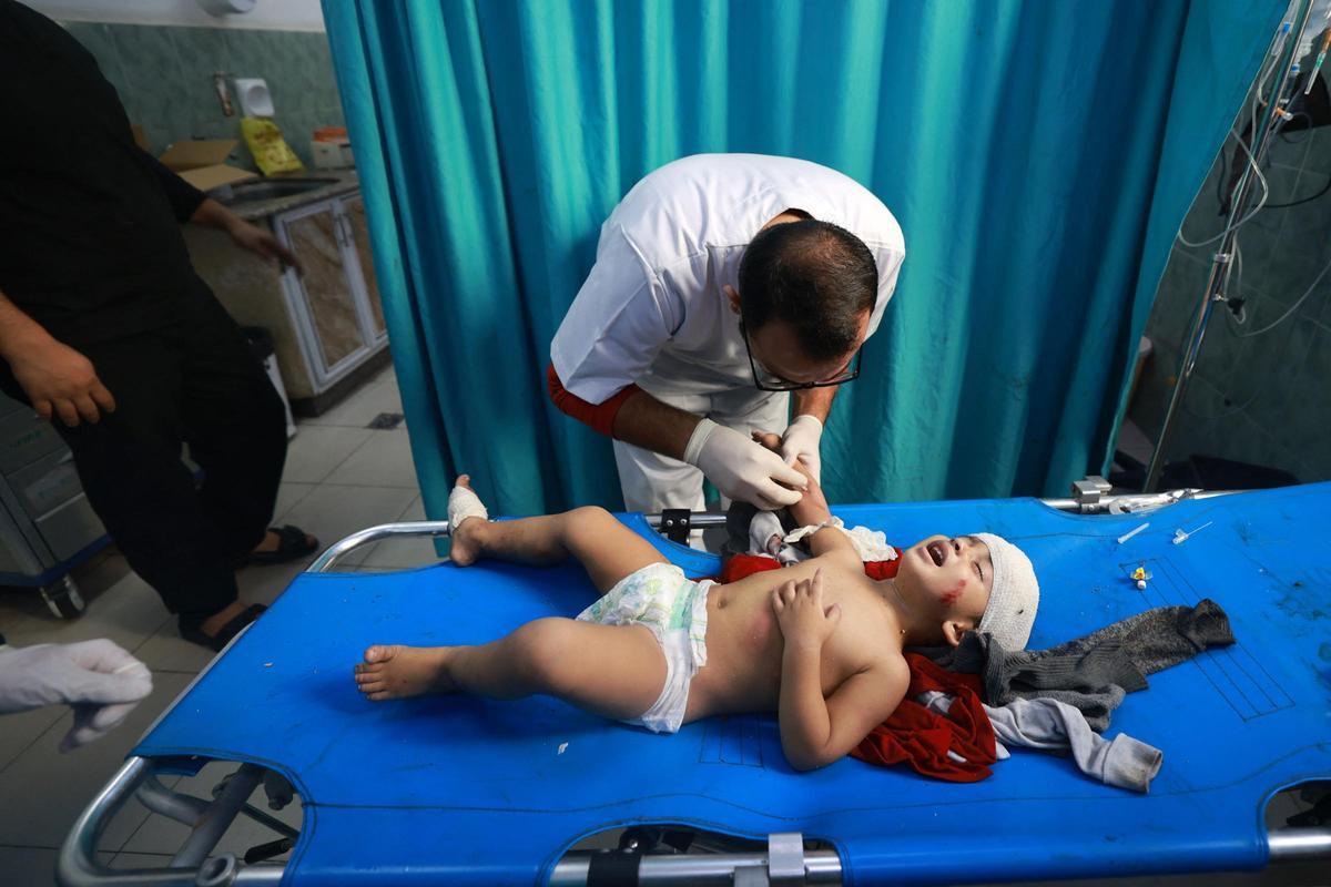 Un médico palestino brinda atención médica a un niño pequeño herido en un ataque israelí en Rafah, en el sur de la Franja de Gaza, en el hospital de al-Najjar el 1 de diciembre de 2023, después de que se reanudaran las batallas entre Israel y el movimiento Hamás.