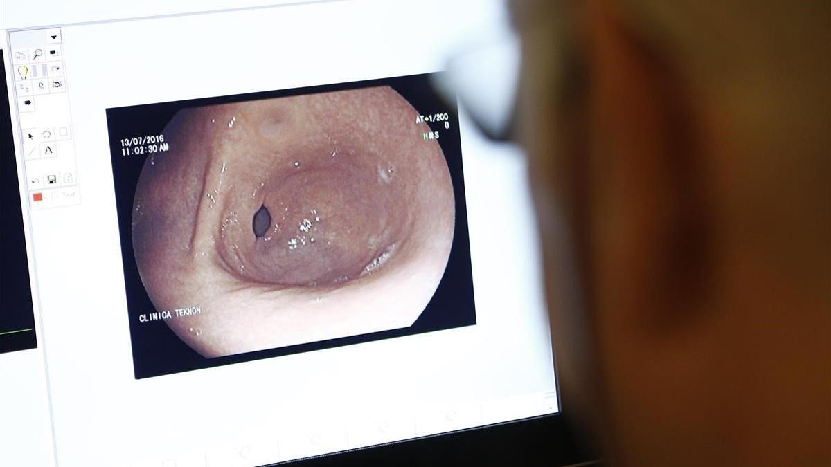 Endoscopia en el Centro Médico Teknon de Barcelona