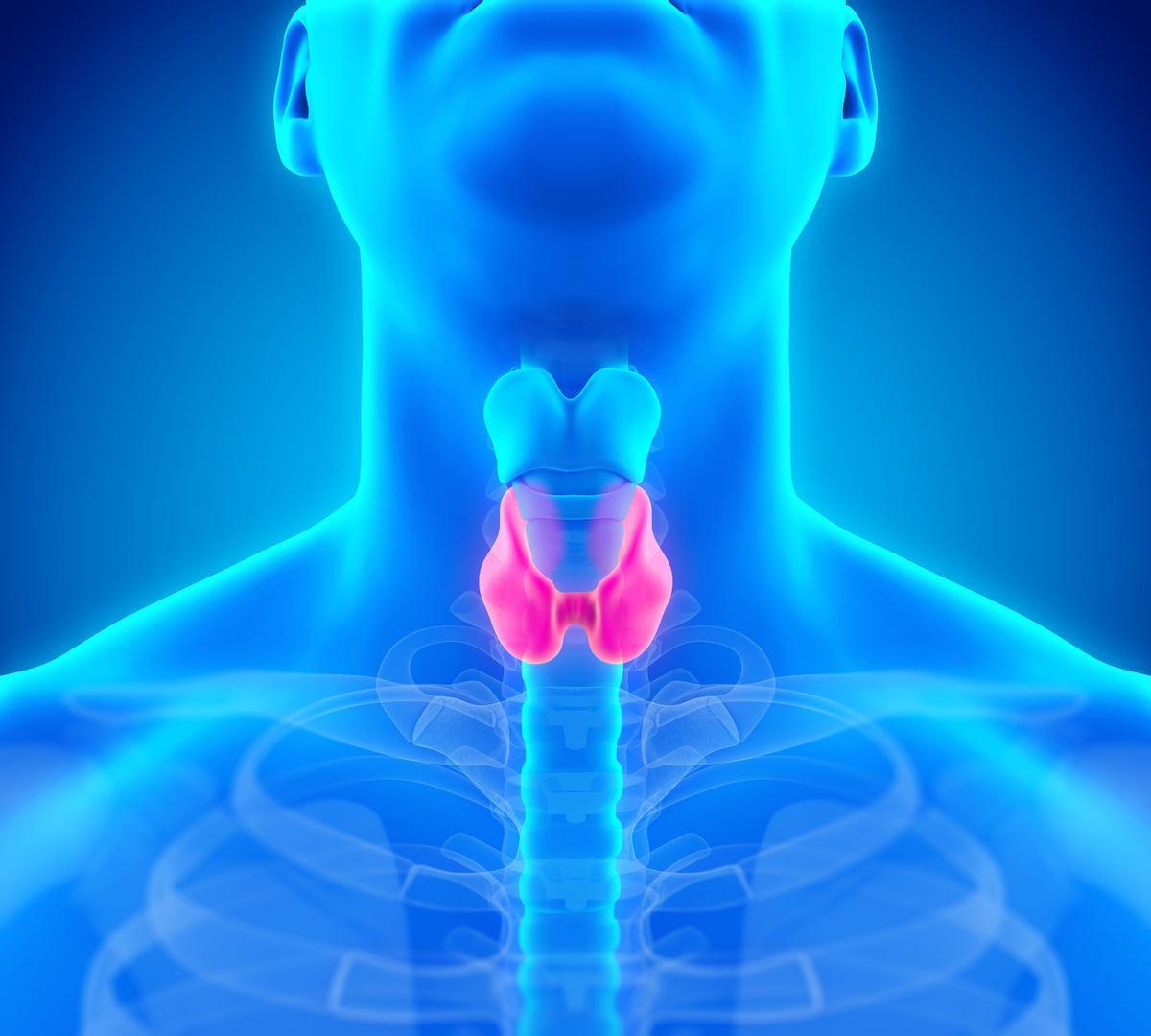 ilustración de la anatomía de la glándula tiroides humana causante del hipotiroidismo