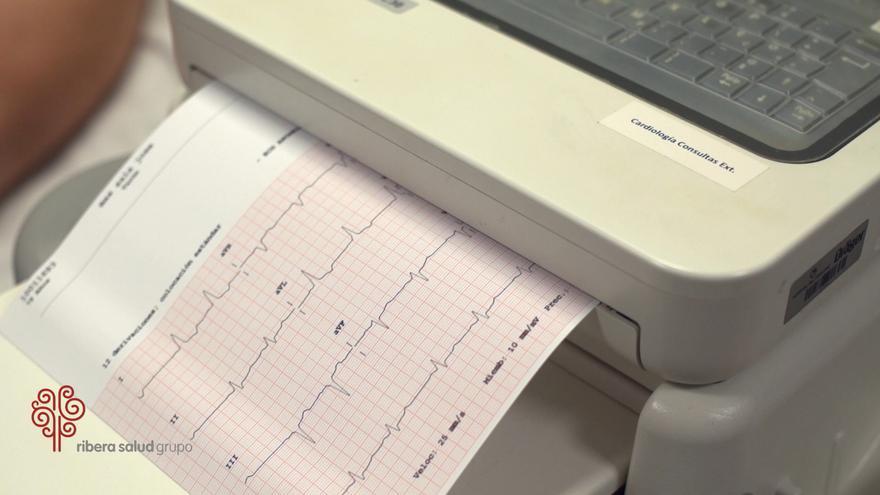 Ribera Hospital de Molina recuerda la importancia de controlar los factores de riesgo cardiovascular