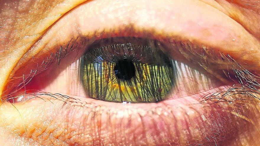 La alergia ocular es una respuesta exagerada del sistema inmunológico de los ojos.