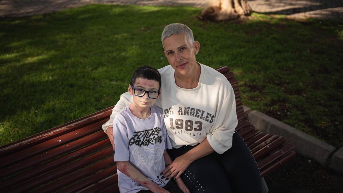 Asier Díaz, un niño de doce años con piel de mariposa, junto a su madre, Eugenia Méndez.
