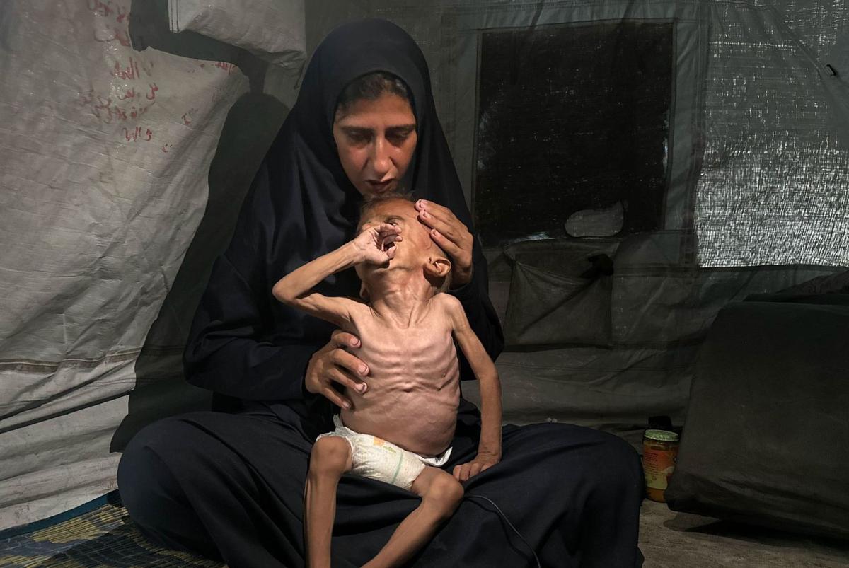 La fam com a arma de guerra