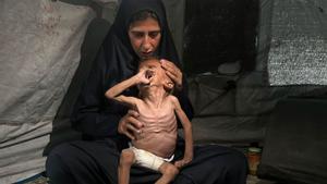 La fam com a arma de guerra