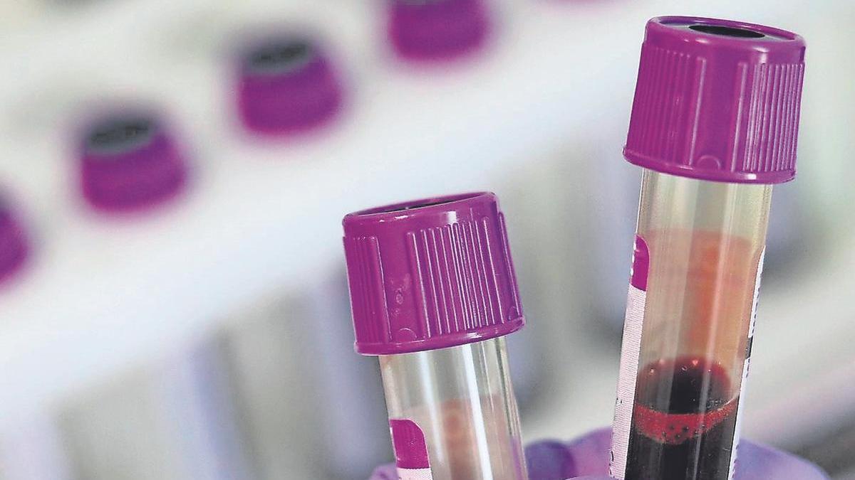 Muestras sanguíneas que necesitará el chip para que los profesionales sanitarios realicen el seguimiento.