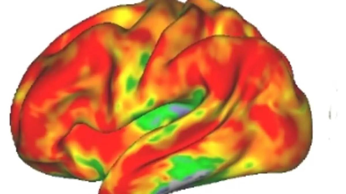 Así se ve el cerebro por efecto de la psilocibina de los &quot;hongos mágicos&quot;