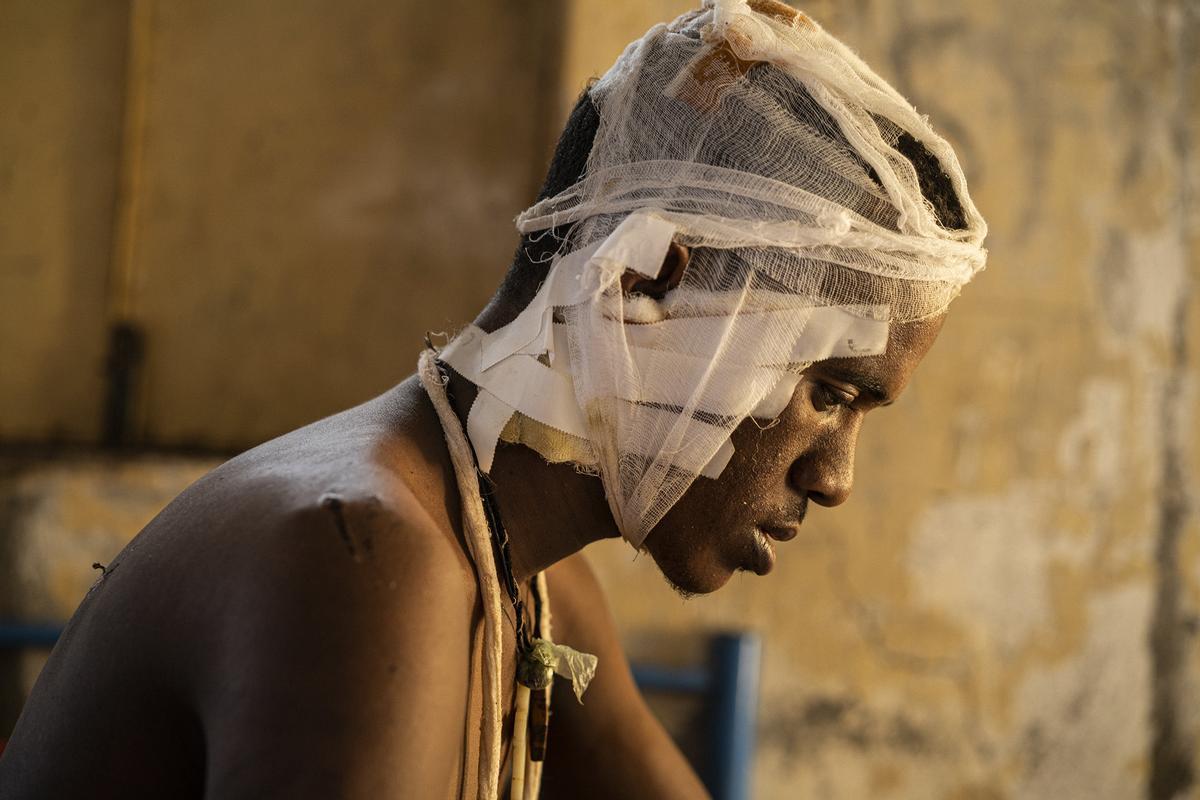Habrehaley (21) fue golpeado antes de ser dejado por muerto por milicianos de Amhara aliados con el gobierno federal. Hamdayet, Sudán.