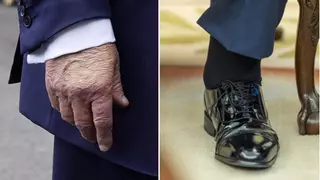 Trump se somete a un chequeo médico por hinchazón de piernas y cardenales en las manos