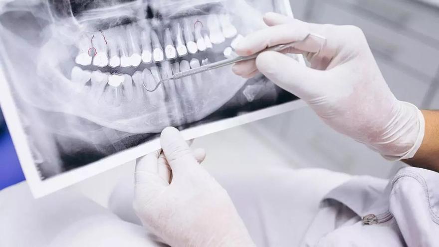 Renta 2023 Castellón: ¿Qué tratamientos del dentista te puedes deducir en la declaración?