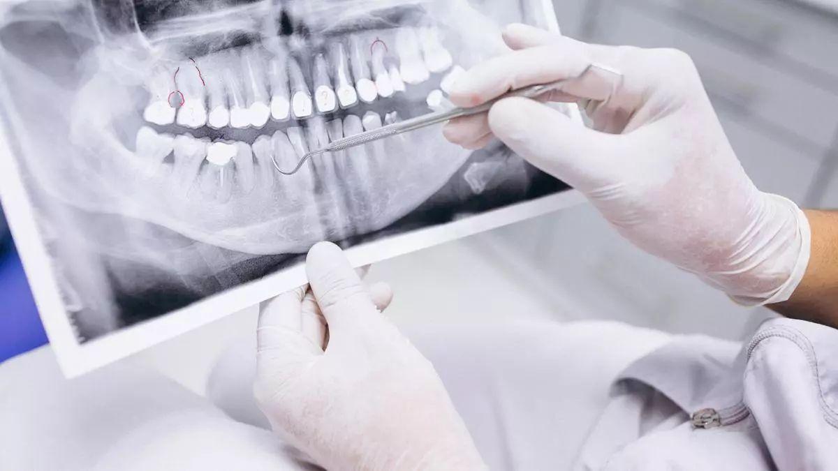 Renta 2023: ¿Qué tratamientos del dentista te puedes deducir en la declaración?