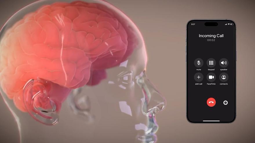 Elon Musk anuncia el implante del primer chip cerebral en un humano