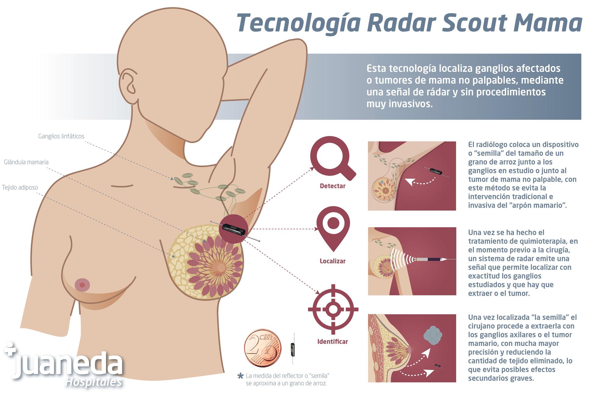 Tecnología Radar Scout Mama