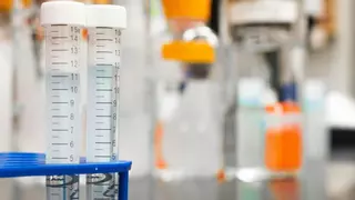 Chema González de Echávarri, neurólogo: "Este es el fármaco revolucionario para tratar la ELA que se ha aprobado recientemente en Europa"