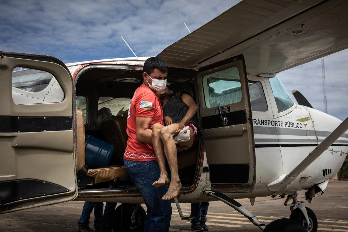 Niño indígenas yanomami desnutridos reciben tratamiento en el Hospital Infantil Santo Antonio en Boa Vista, estado de Roraima, Brasil.