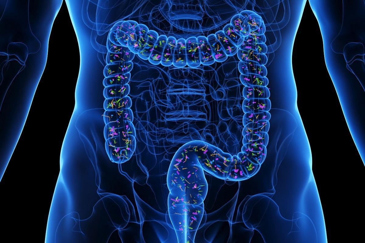 Las personas con lupus sufren alteraciones en la microbiota intestinal.