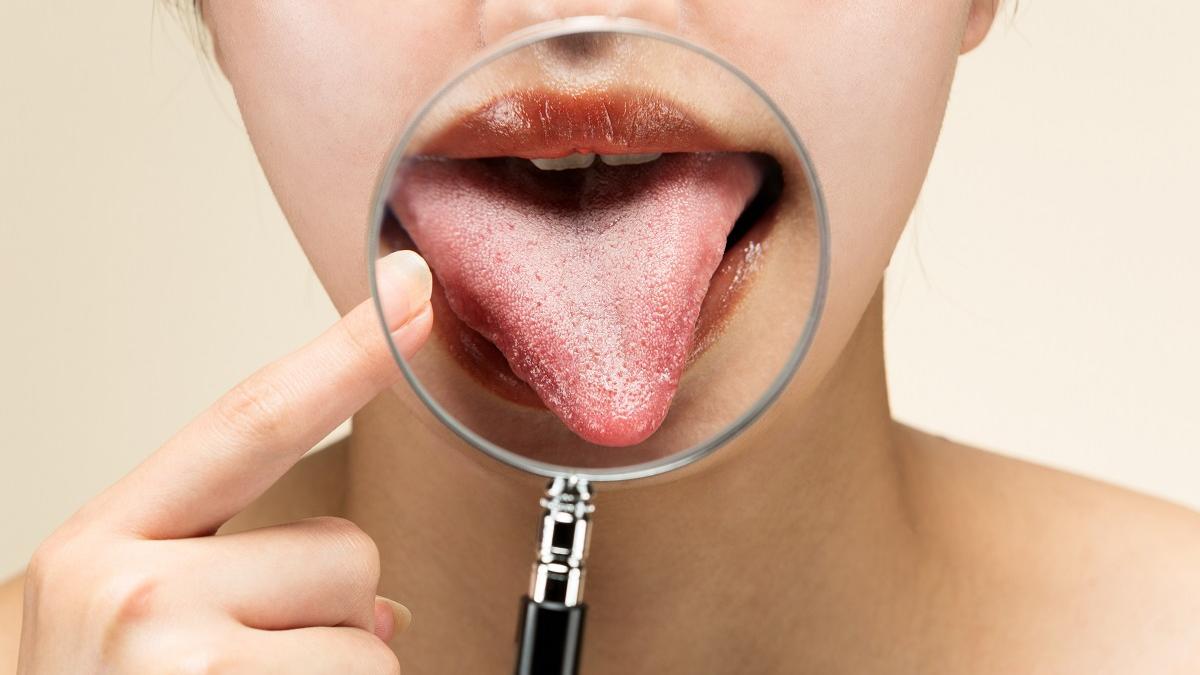 What does the tongue tell us about our health? If you have this color, you should go to the doctor