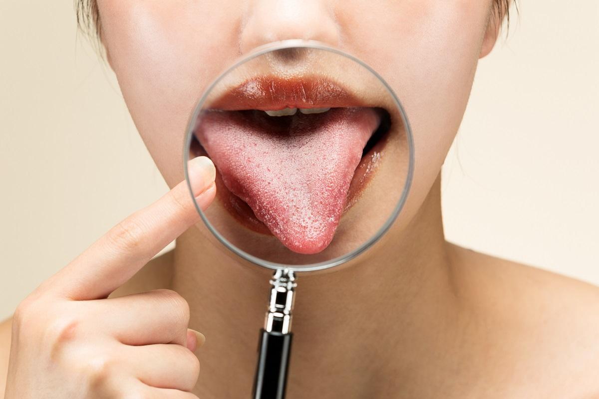 ¿Qué nos dice la lengua sobre nuestra salud?