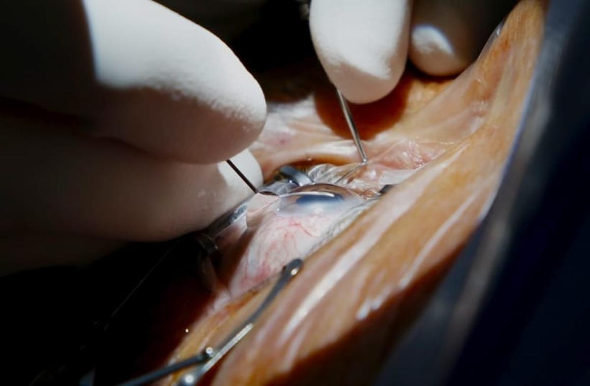 Una de las intervenciones quirúrgicas vistas con pleno detalle