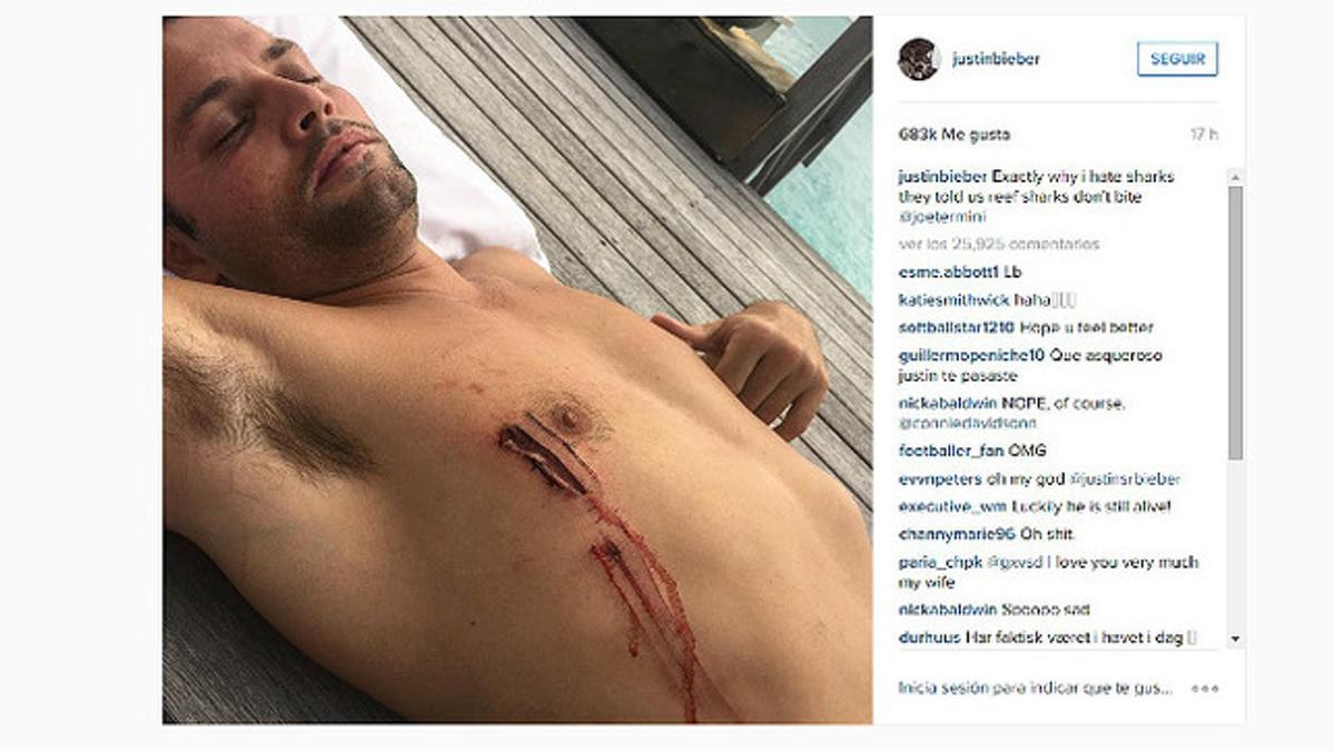 Un amigo de Justin Biber es atacado por un tiburón en su presencia