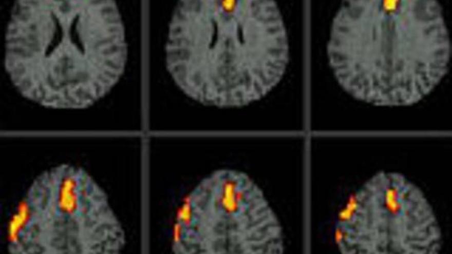 Los artistas tienen una estructura cerebral diferente, según un estudio