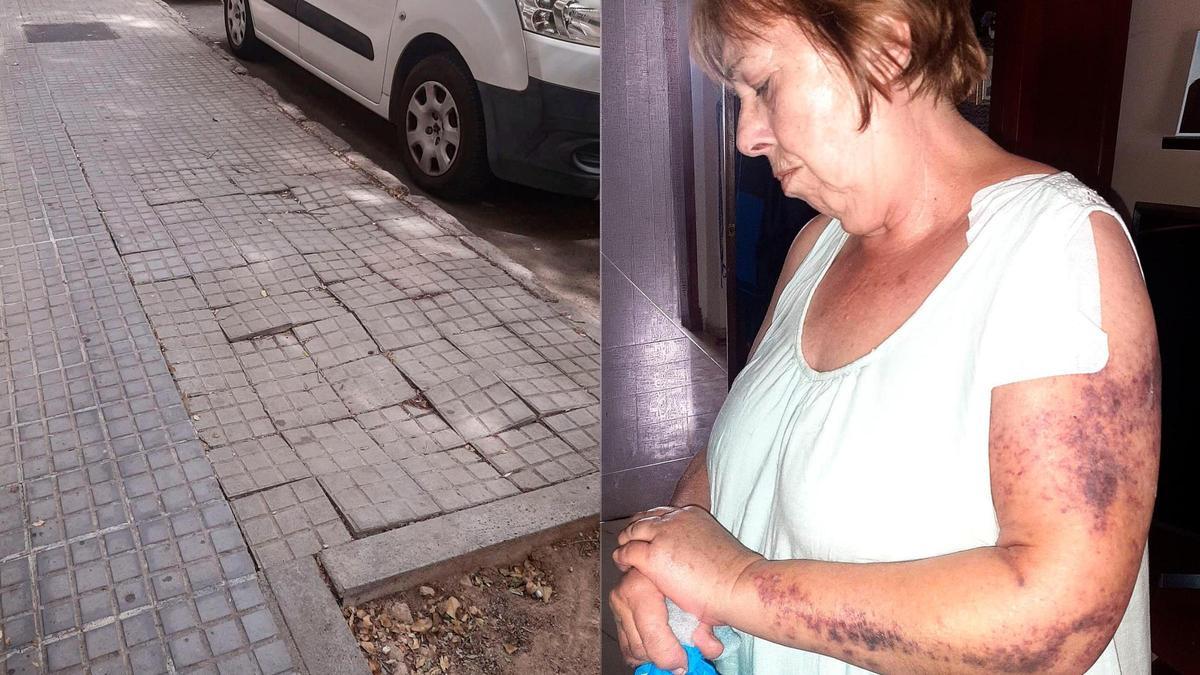 La mujer, que ahora tiene 75 años, se cayó en una calle en el barrio de Son Oliva que estaba en muy mal estado, tal y como se puede ver en la imagen.