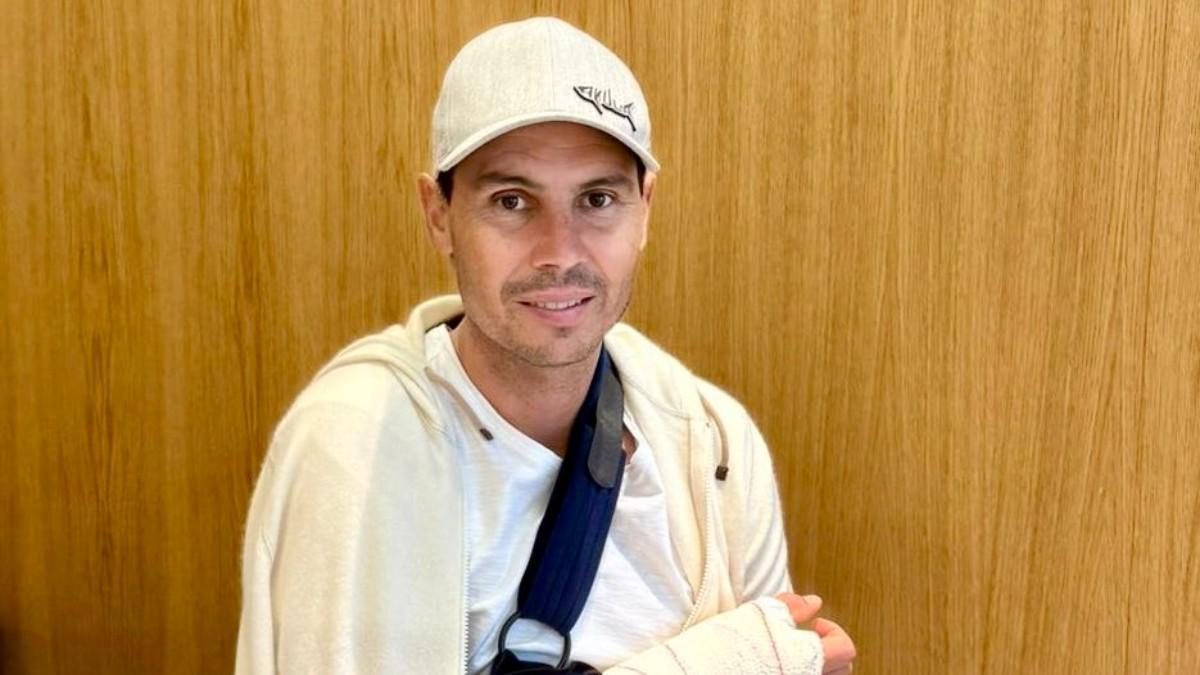 Rafa Nadal, operado de la mano derecha