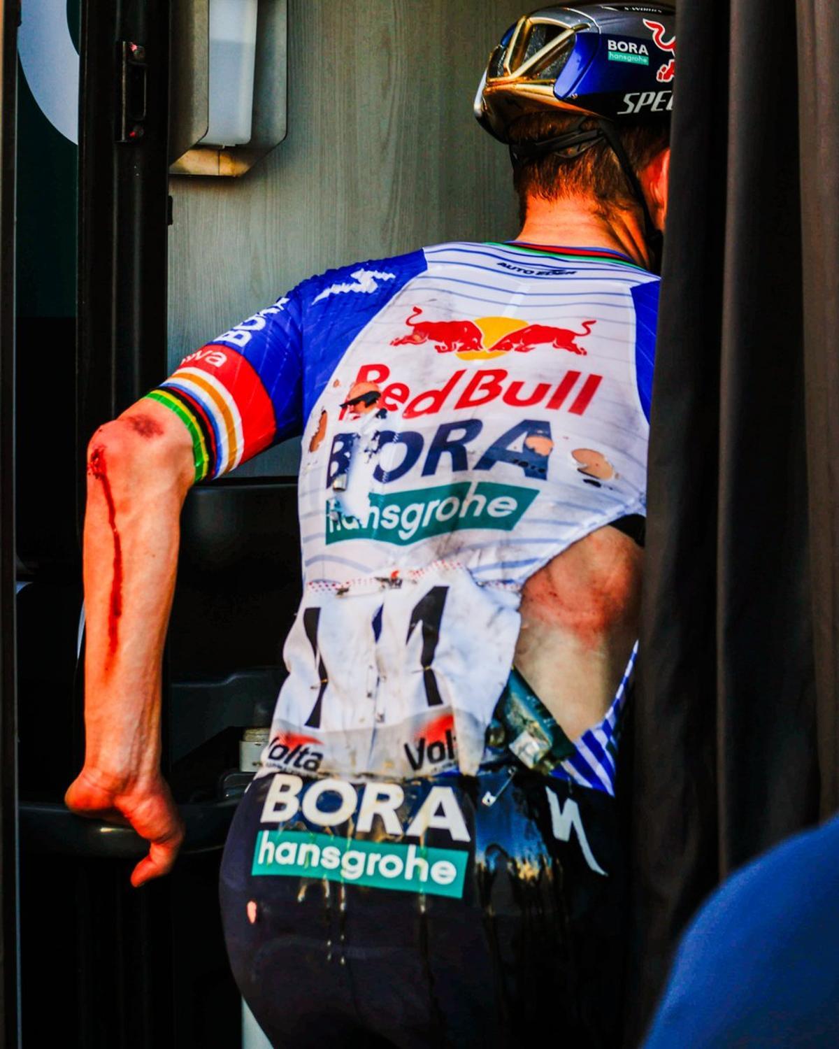 Evenepoel, con las heridas, en la meta de Vila-seca.