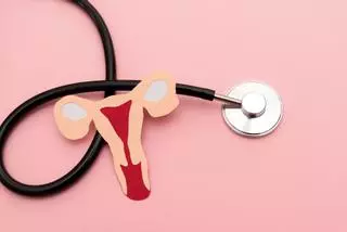 Endometriosis, o la enfermedad que muchas mujeres confunden con un dolor menstrual “normal”
