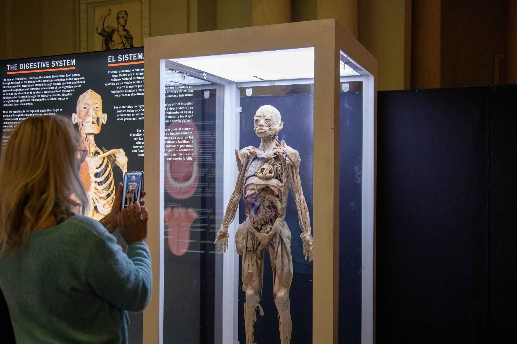 Präparierte menschliche Körper und Organe in der Ausstellung "Bodies" bewundern