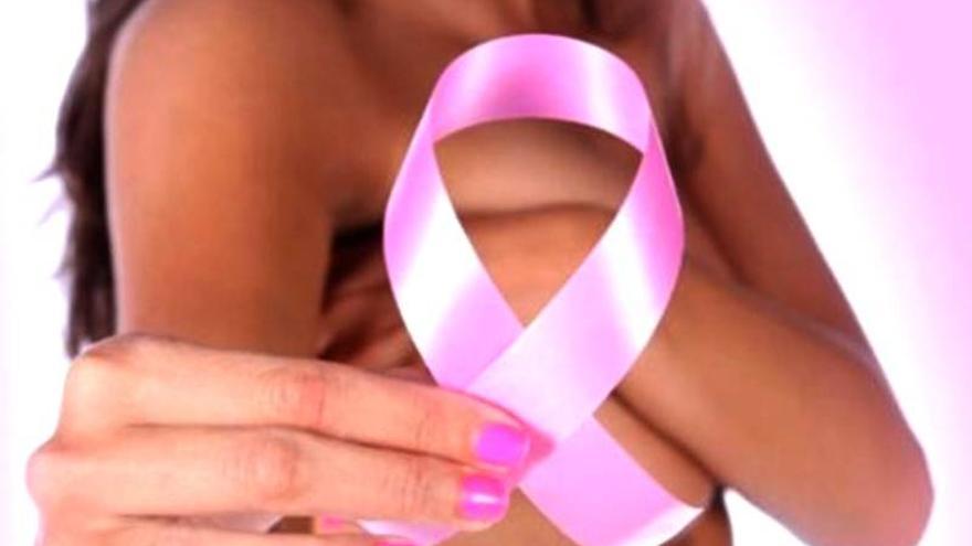 La proteína SOX2 provoca la reaparición del cáncer de mama y que este sea más agresivo