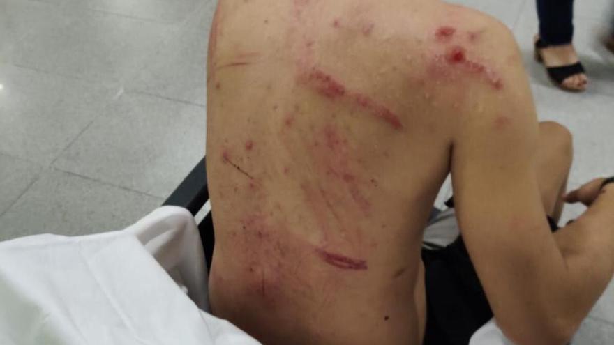 Herido al sufrir una paliza tras la protesta independentista en Murcia
