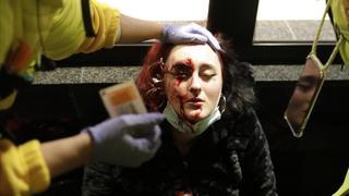 Sàmper indica que "todo apunta" que una bala de 'foam' dejó sin ojo a una joven en las protestas por Hasél