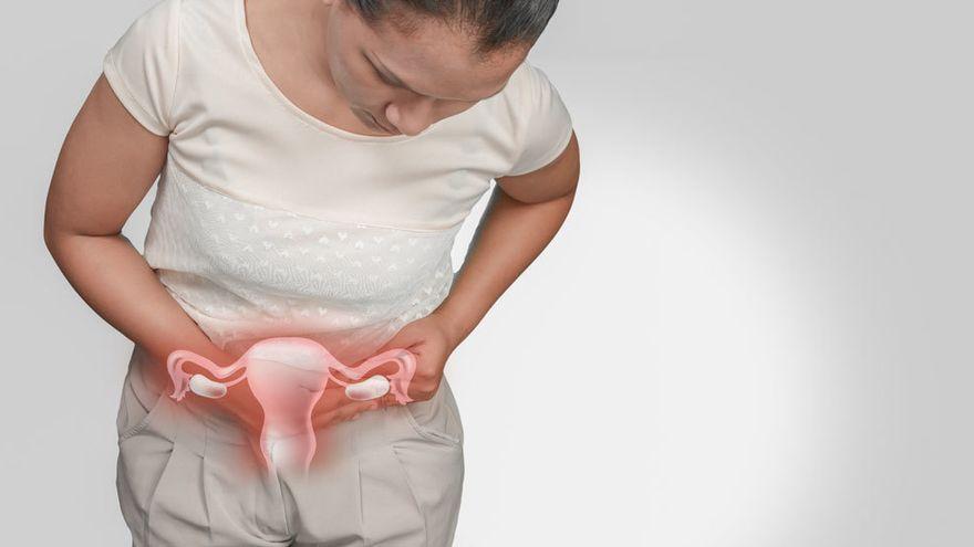 Existen diferentes tratamientos para mejorar la calidad de vida de las mujeres con endometriosis.