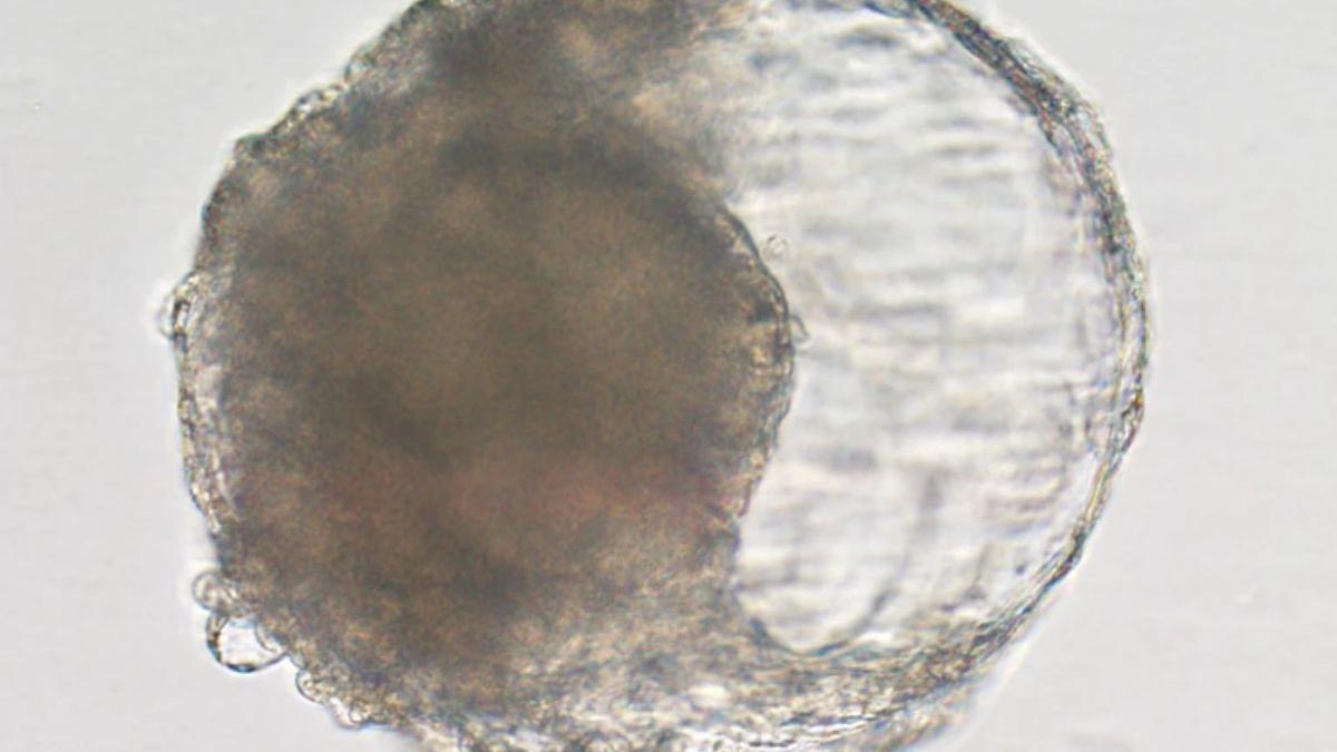 Un blastoide creado a partir de células madre de mono cynomolgus: se asemeja a las primeras etapas de un embrión y desencadenó cambios similares a los de un embarazo cuando se implantó en el útero de un mono hembra.
