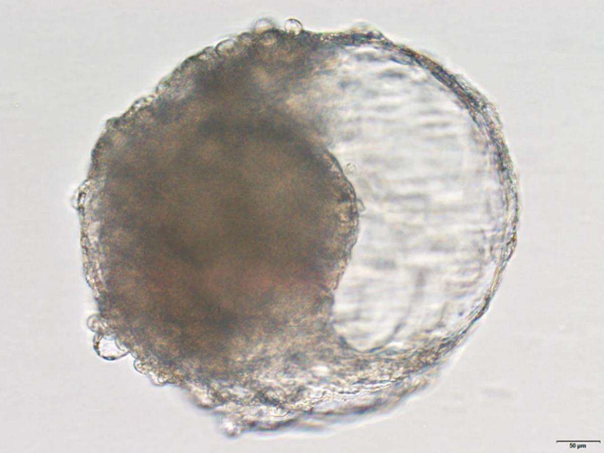 Un blastoide creado a partir de células madre de mono cynomolgus: se asemeja a las primeras etapas de un embrión y desencadenó cambios similares a los de un embarazo cuando se implantó en el útero de un mono hembra.