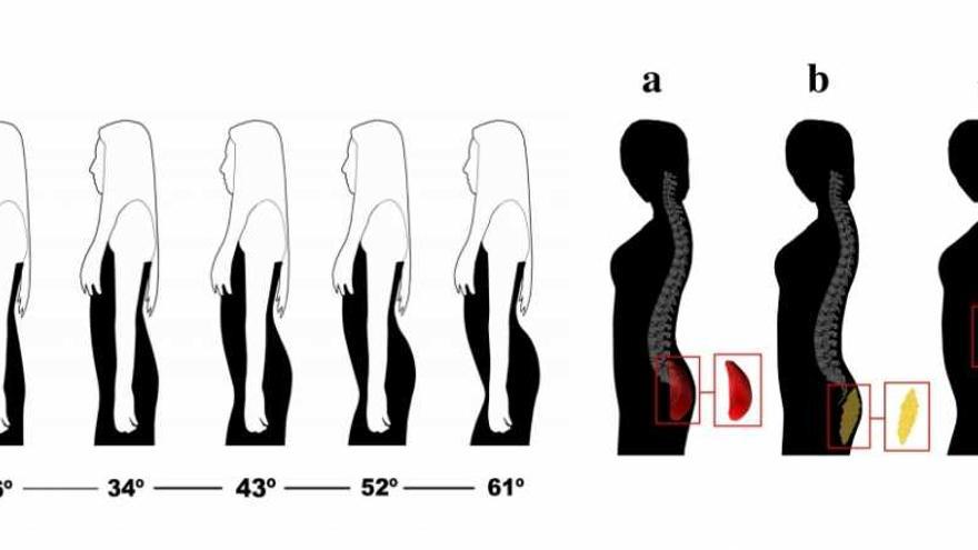 Los 5 tipos de glúteos tienen un significado en salud