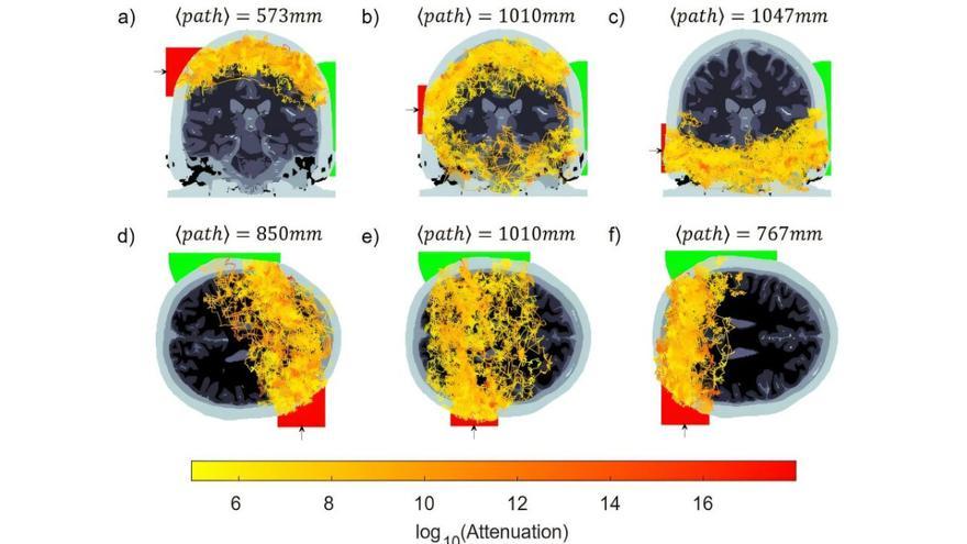 Primera transmisión de luz a lo largo de todo el cerebro humano