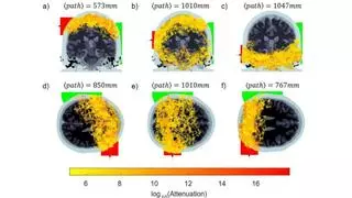 Primera transmisión de luz a lo largo de todo el cerebro humano