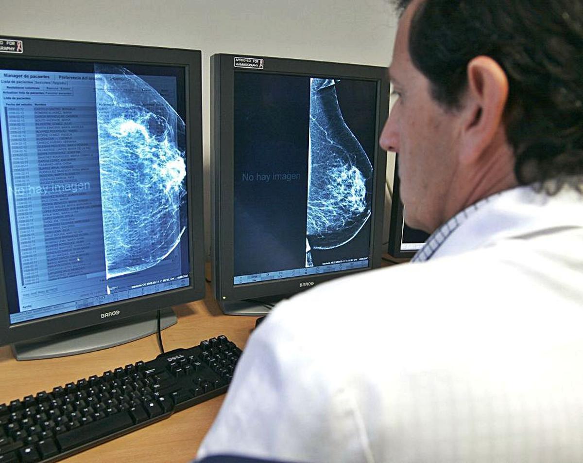 Un médico consulta una mamografía. | L.O.