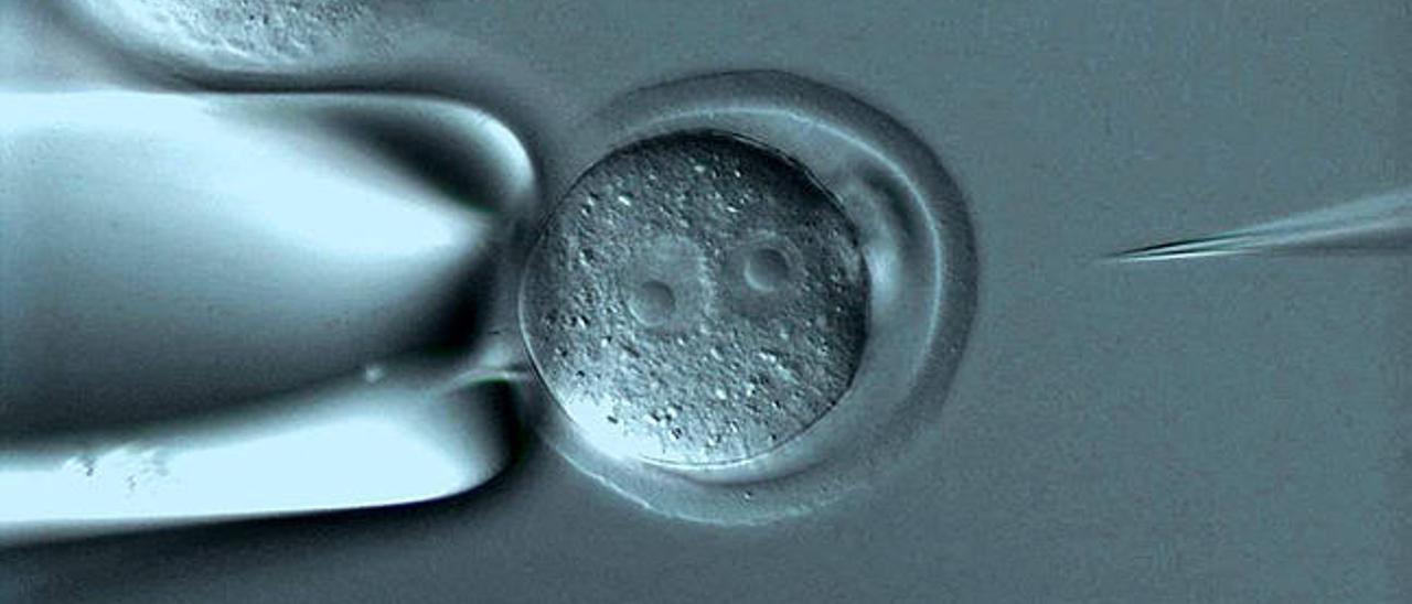 Imagen de una fecundación in vitro.