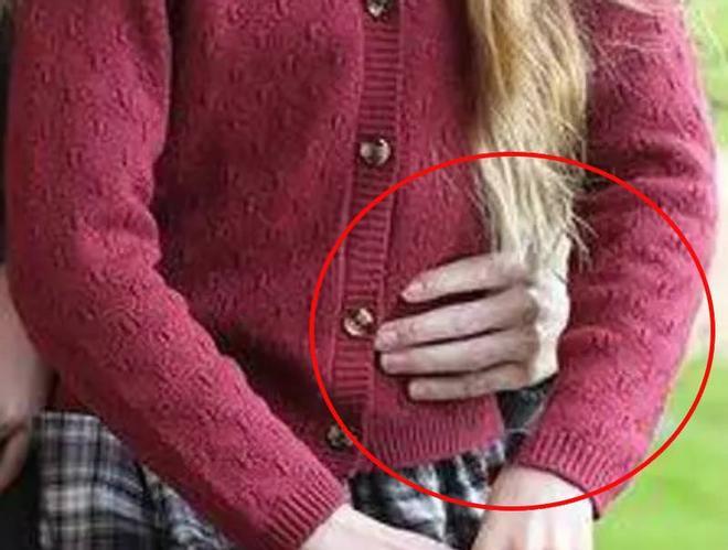 La mano sin anillo de boda de Kate Middleton