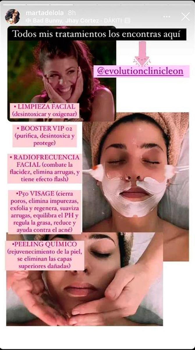 Tratamiento facial de Lola ('LIDLT3')