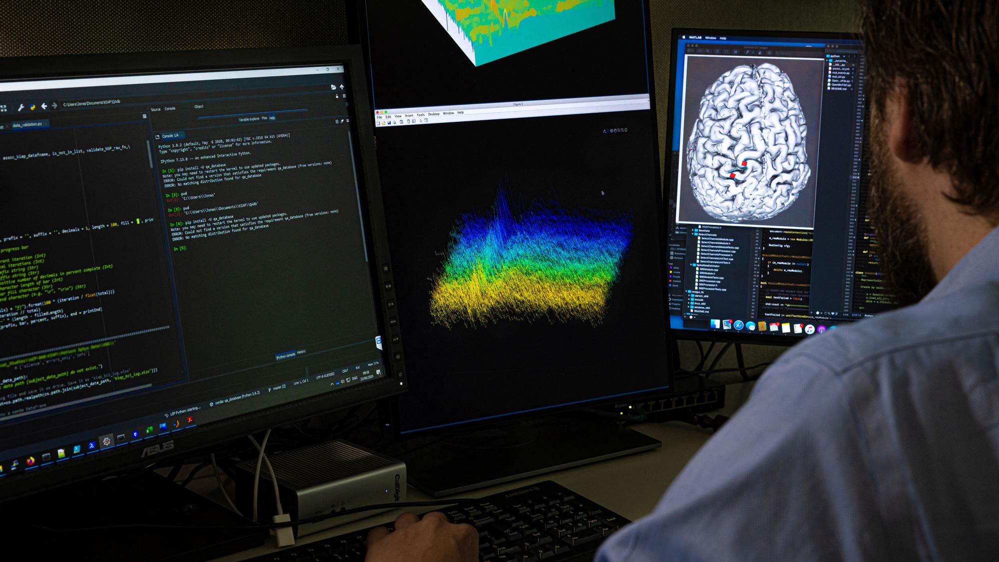 Un investigador trabaja en un estudio para conectar el cerebro de un paciente a un ordenador.