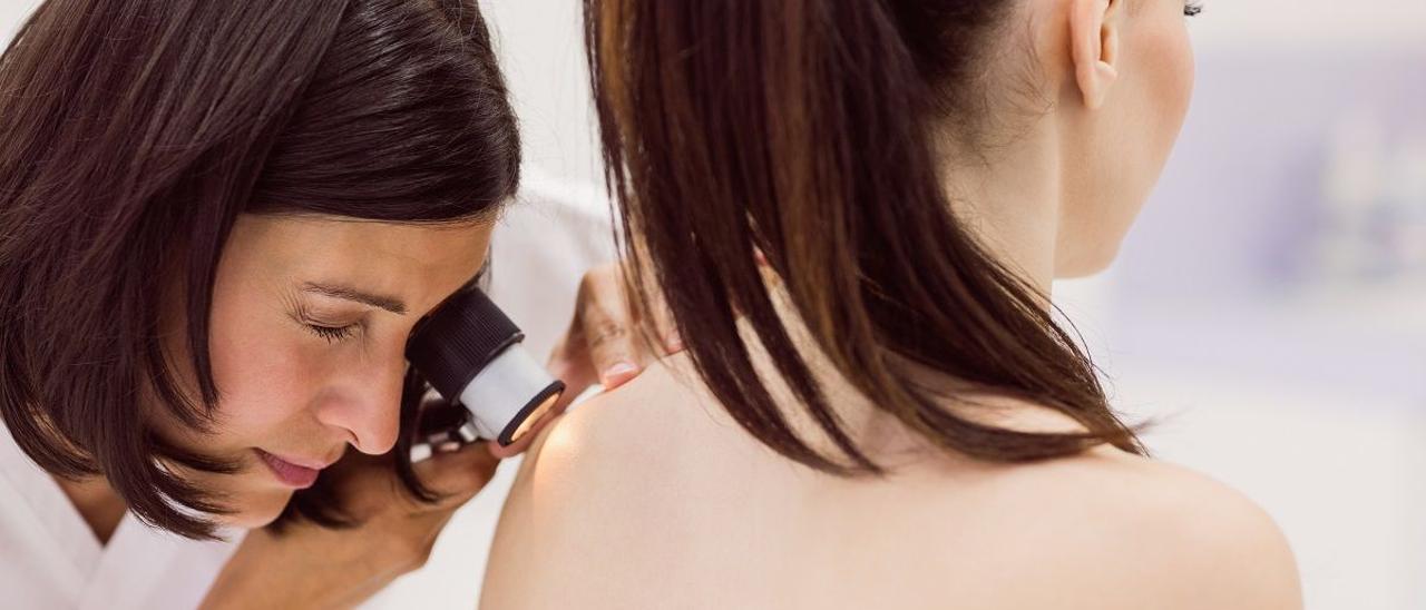 Los expertos en oncología advierten de que el melanoma va en aumento en España