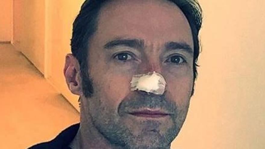 Hugh Jackman, operat per sisena vegada de càncer de pell