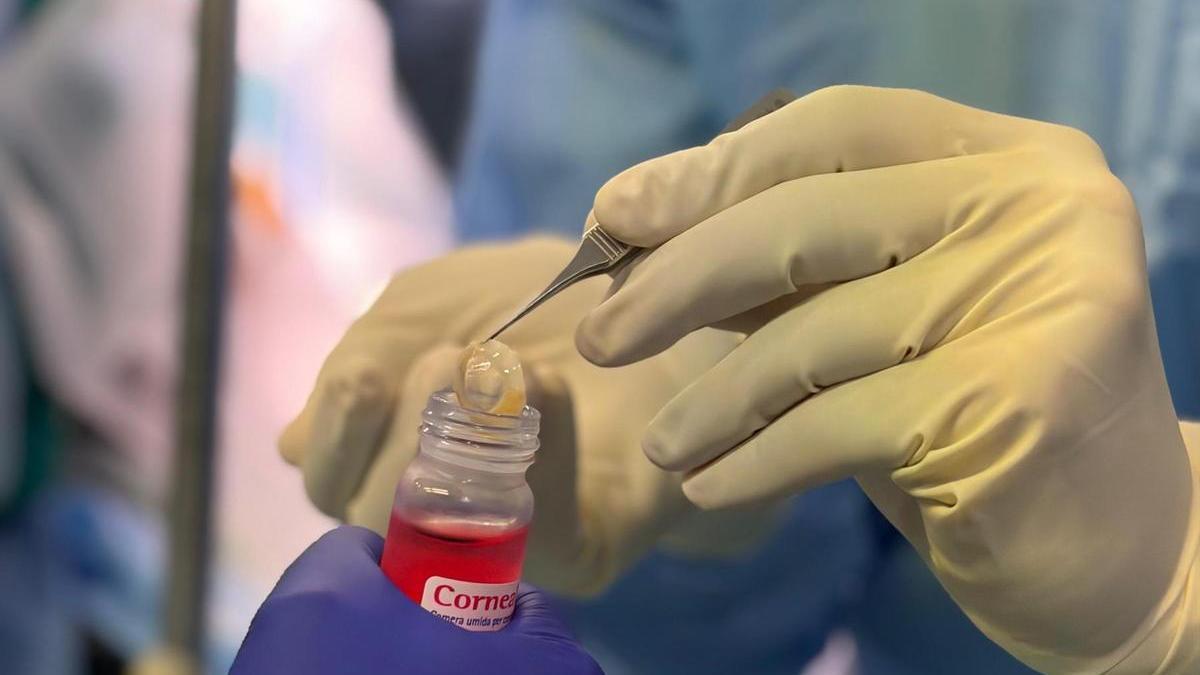 Donación de córneas en el Hospital Universitario de Torrevieja