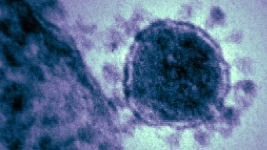 Imagen de archivo de un coronavirus.