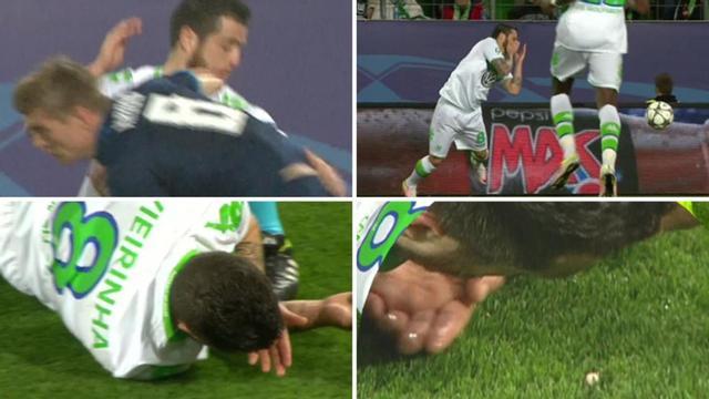 Vieirinha, sin diente