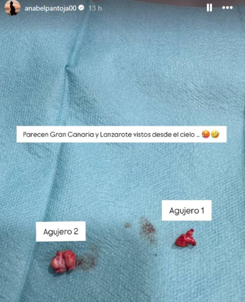 Anabel muestra los bultos que le han extraído de la oreja
